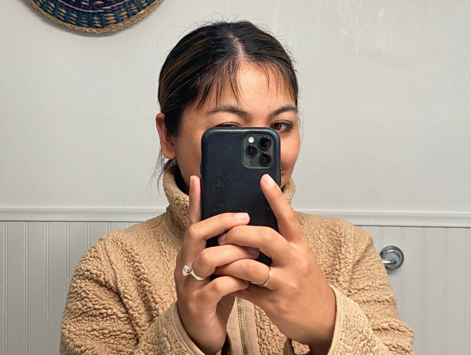 Understanding and Coping with Postpartum Hair Loss